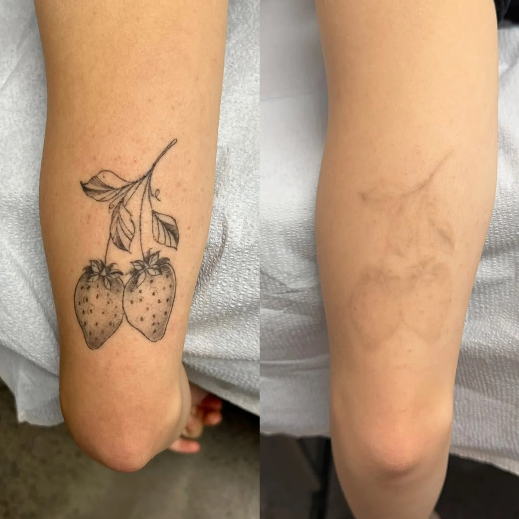 cold compress on swollen tattoo area
