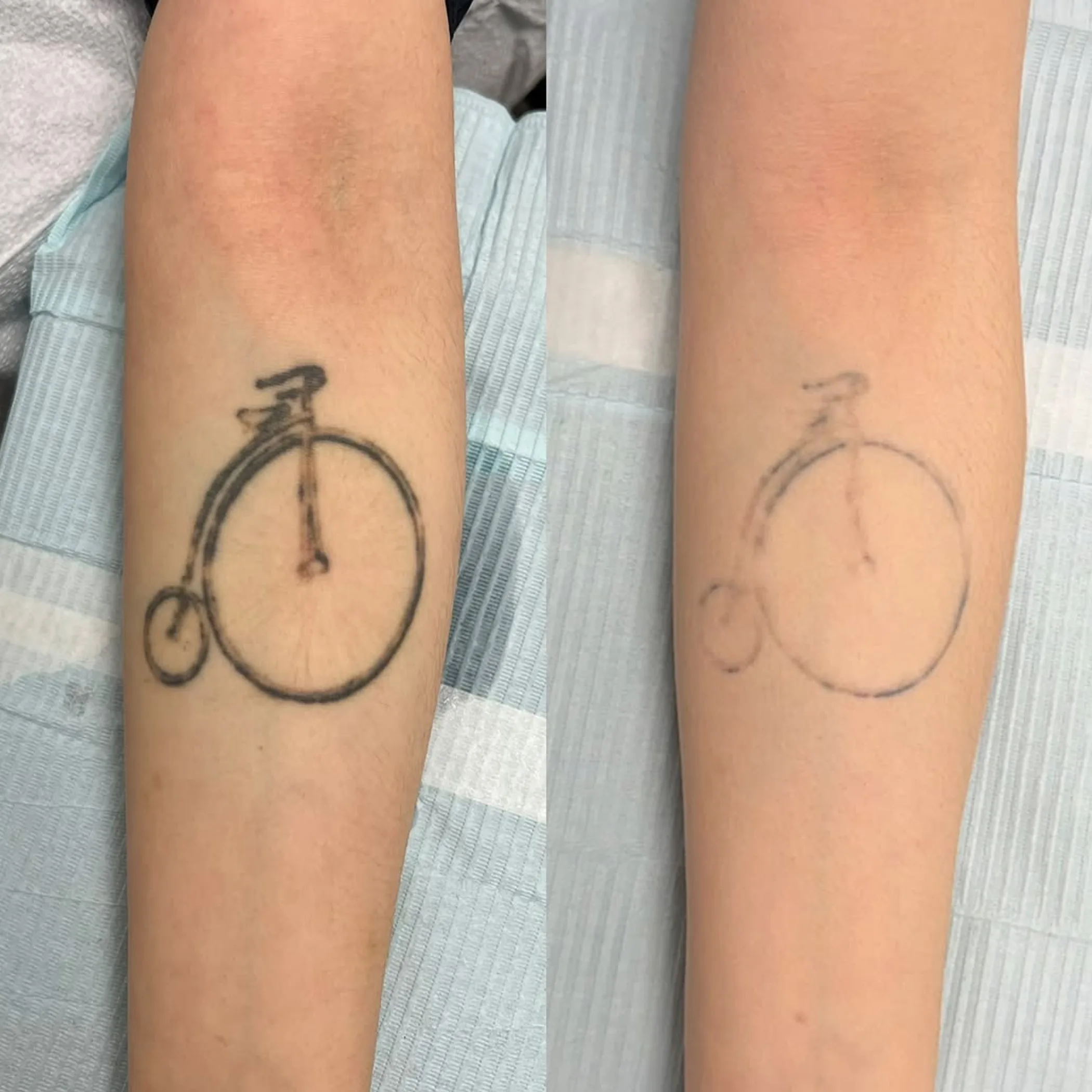 waiting room in australian tattoo removal clinic